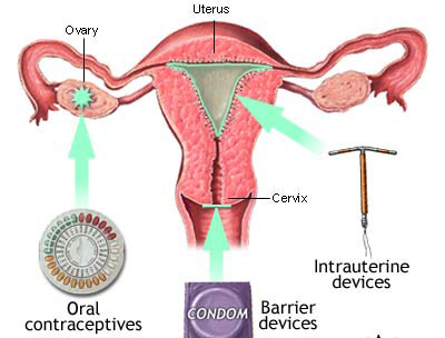 Doğum Kontrol Yöntemleri